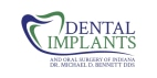 Dental Implants and Oral Surgery of Indiana coupons